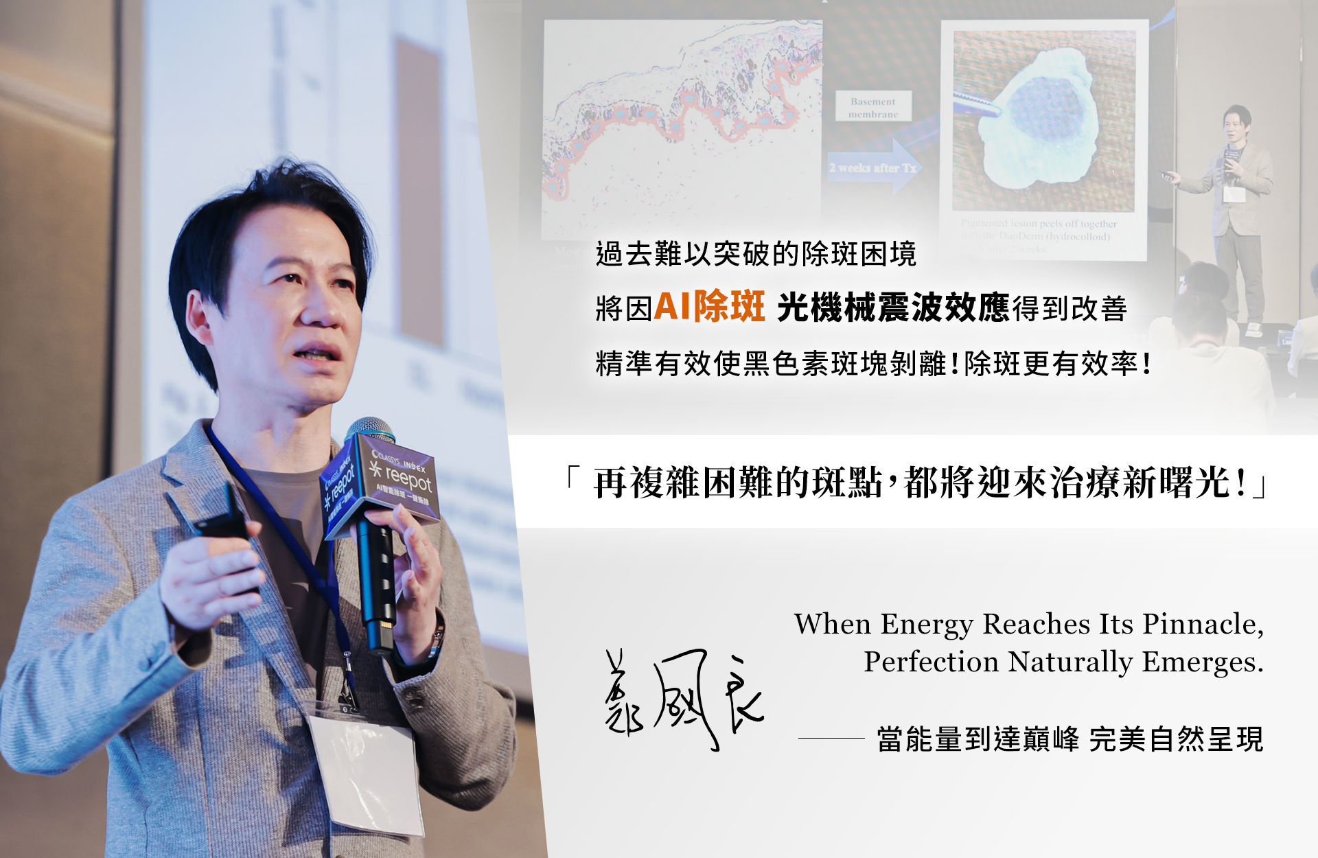 除斑雷射治療迎來新曙光!